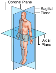 midsagittal plane