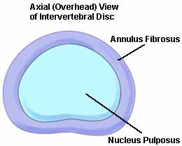 Overhead view of intervertebral disc