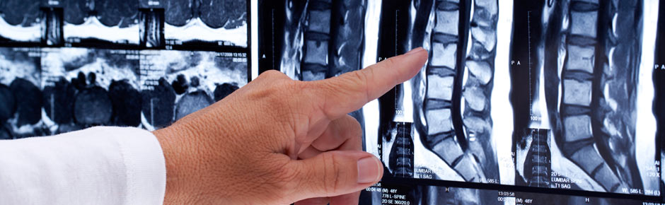 Diagnostic X-Rays