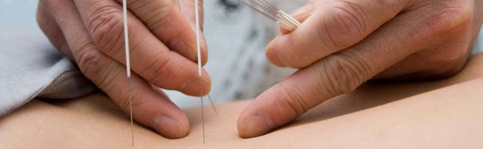 Acupuncture Two Hands